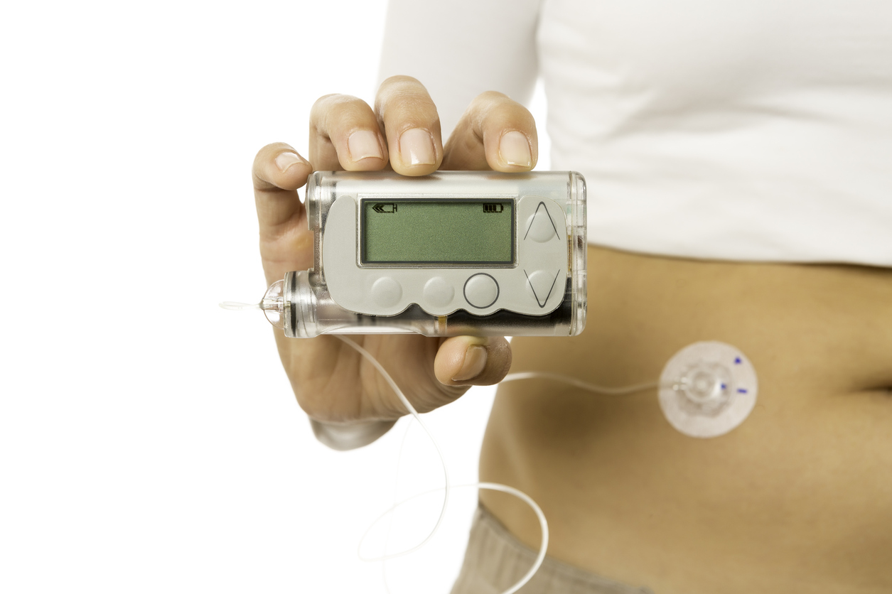 What about insulin pumps?