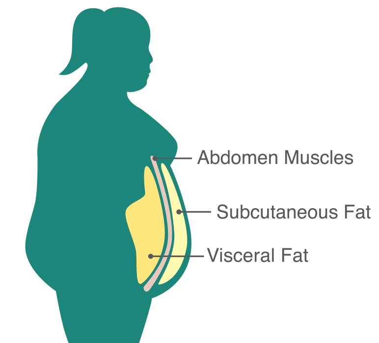 Diagram showing an outline of a female carrying excess weight around her middle. The diagram highlights the deep layer of visceral fat, abdominal muscles and fat just below the skin called subcutaneous fat